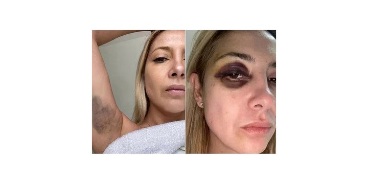 Las fotos de Fabiola Yañez que son parte de la causa contra Alberto Fernández por violencia de género.